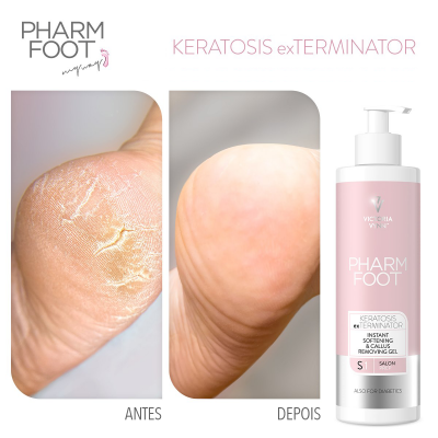 CALLUS REMOVING GEL 300ml